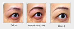 Powdered Eyebrow - Before, Immediately After, Healed